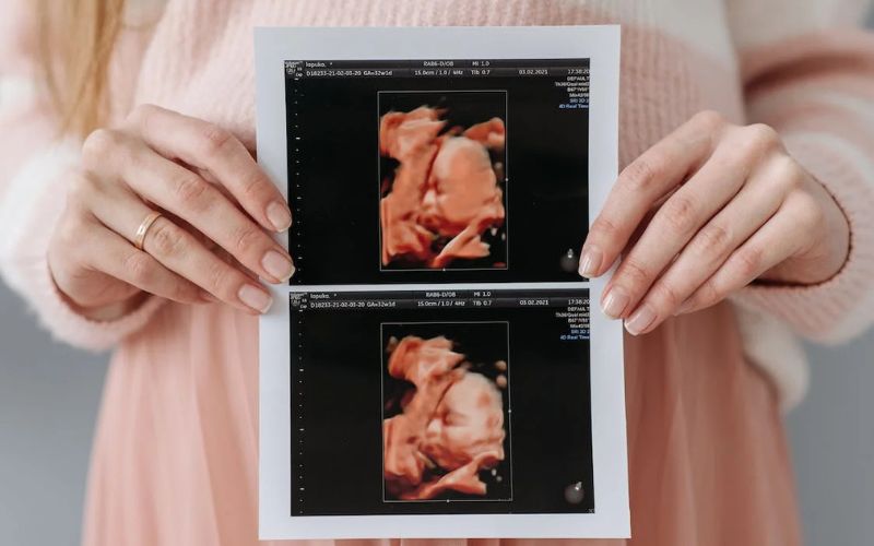 Mikor érdemes babamozira menni?