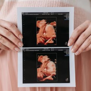 Mikor érdemes babamozira menni?